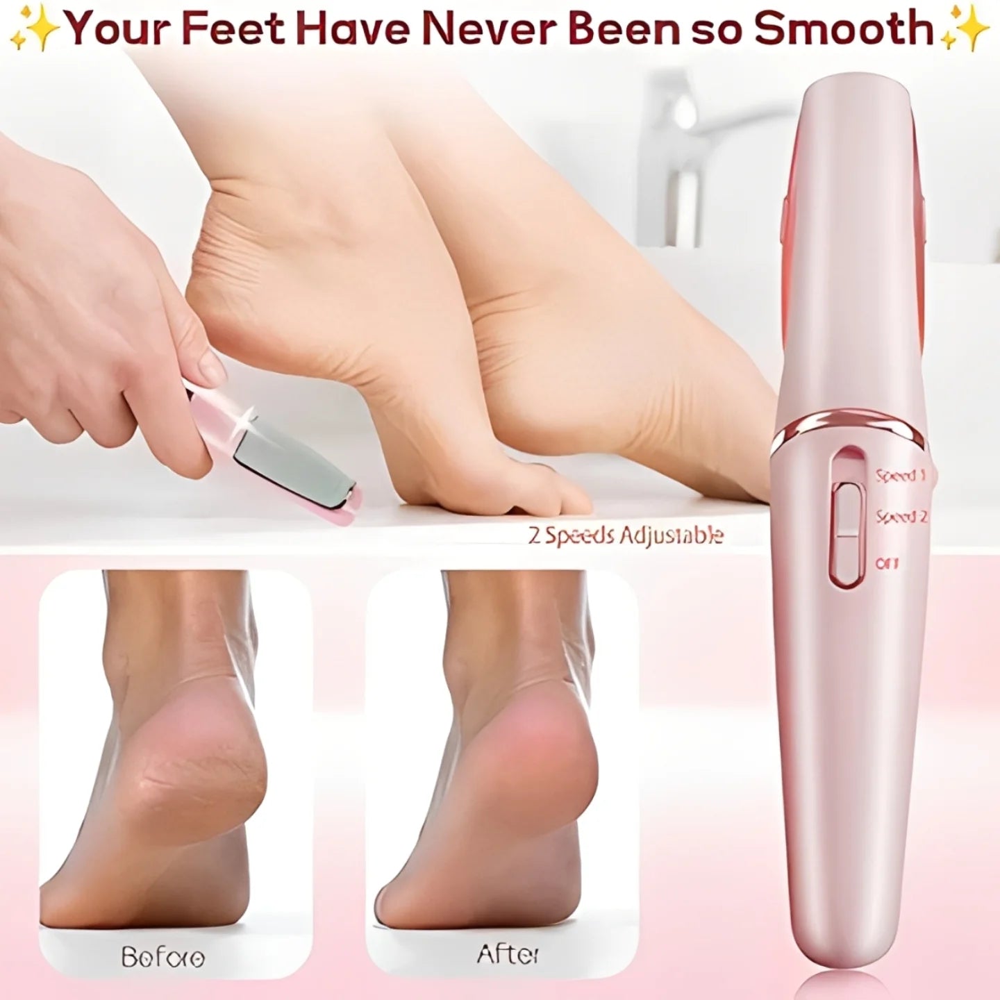 UQQU Electric Foot File, Electric Callus Remover for Feet